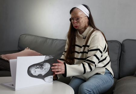 tagreuters.com2024binary_LYNXMPEK0L003-VIEWIMAGE