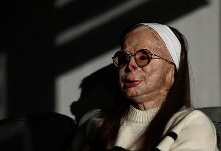 tagreuters.com2024binary_LYNXMPEK0L005-VIEWIMAGE