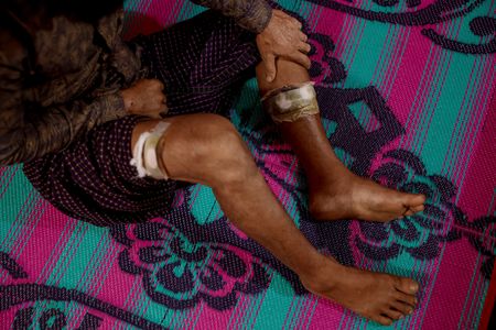 tagreuters.com2024binary_LYNXMPEK6108U-VIEWIMAGE