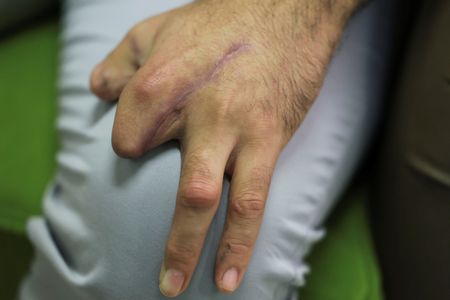 tagreuters.com2025binary_LYNXNPEL8G0BC-VIEWIMAGE