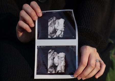 tagreuters.com2025binary_LYNXMPEL2B12I-VIEWIMAGE