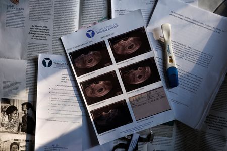 tagreuters.com2024binary_LYNXNPEKB40O5-VIEWIMAGE