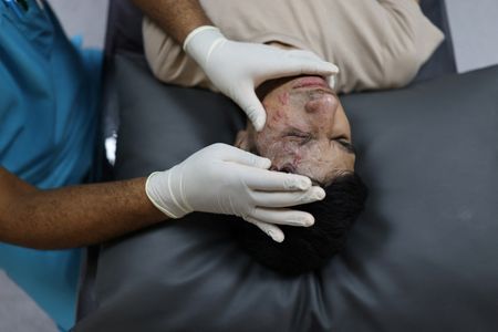 tagreuters.com2025binary_LYNXNPEL0S0CR-VIEWIMAGE